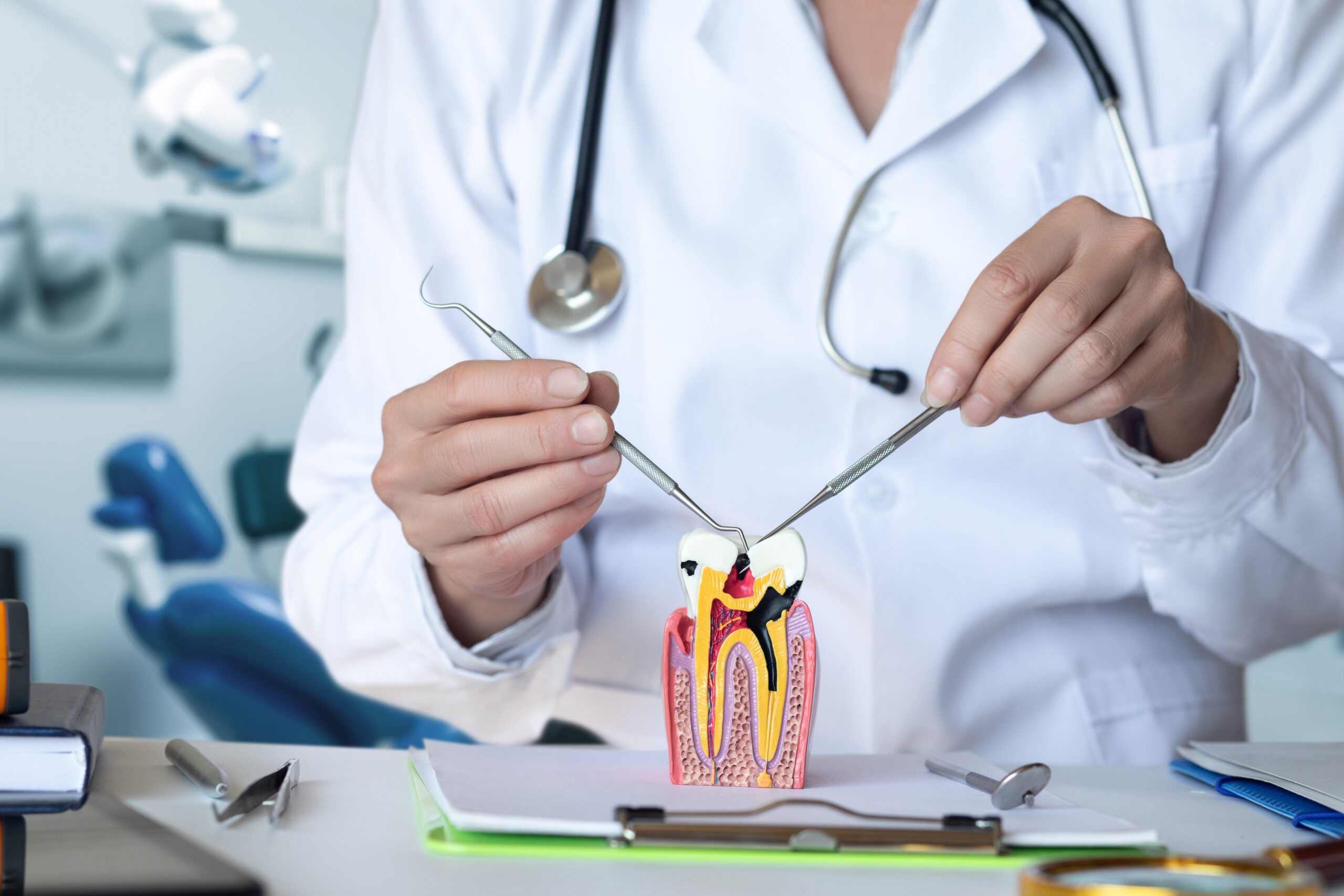 doctor showing a model of a tooth infection, root canal therapy needed to restore function