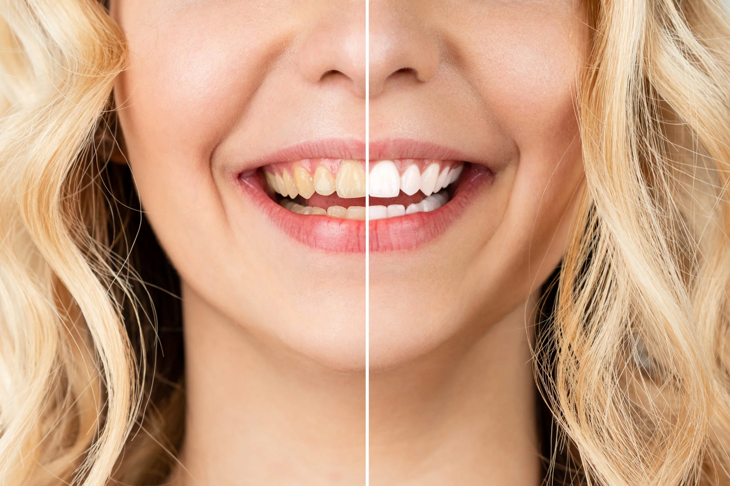 before and after of a cosmetic treatment in Longview
