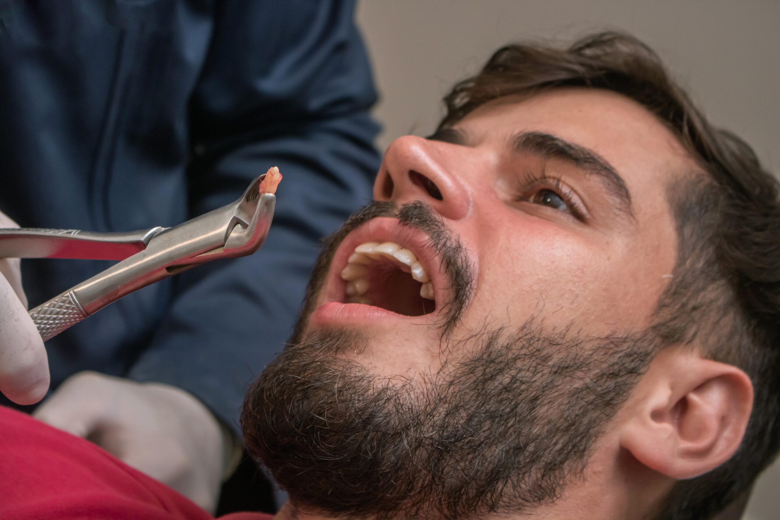man having a tooth pulled in Longview