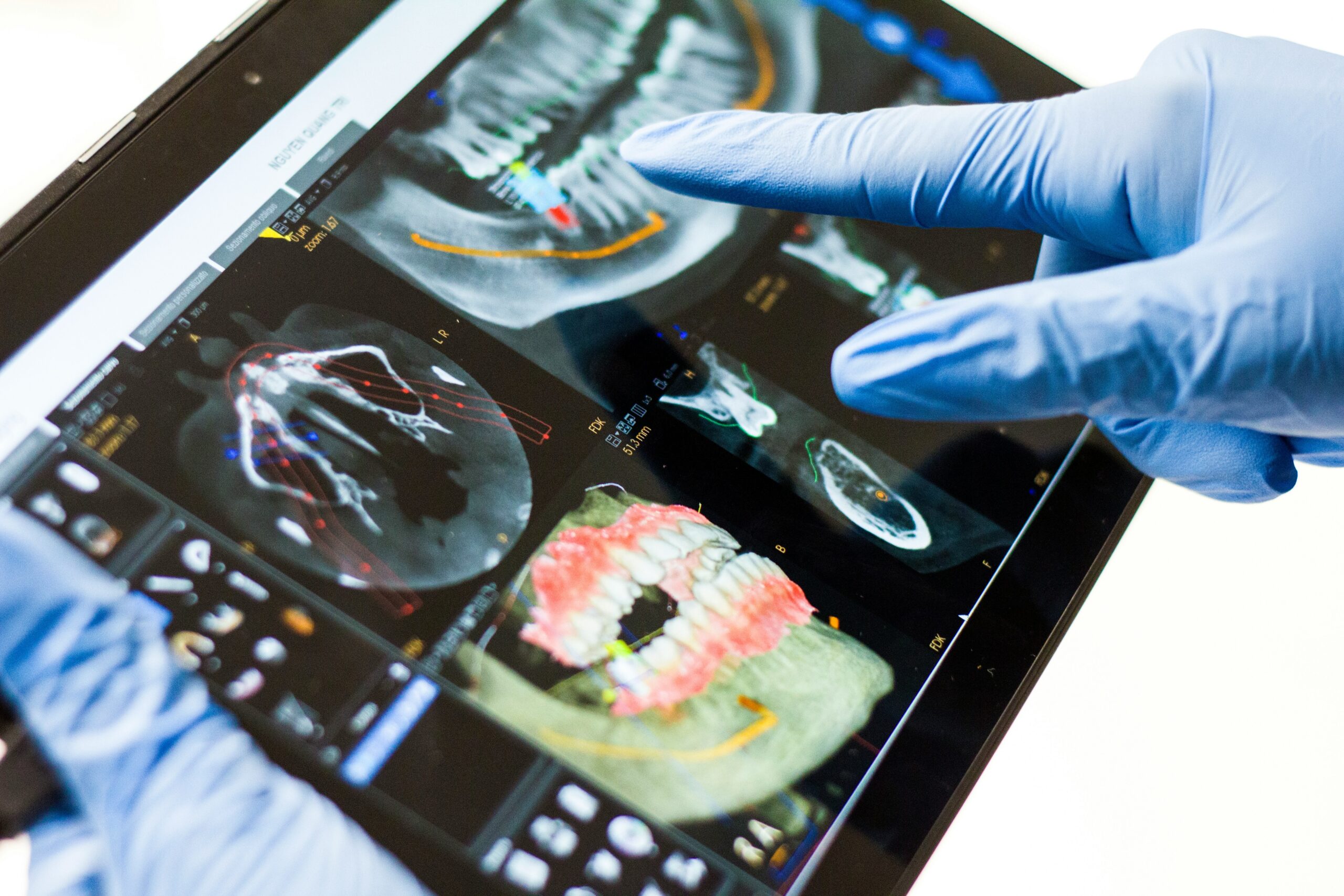 oral cancer screening dentist in hallsville