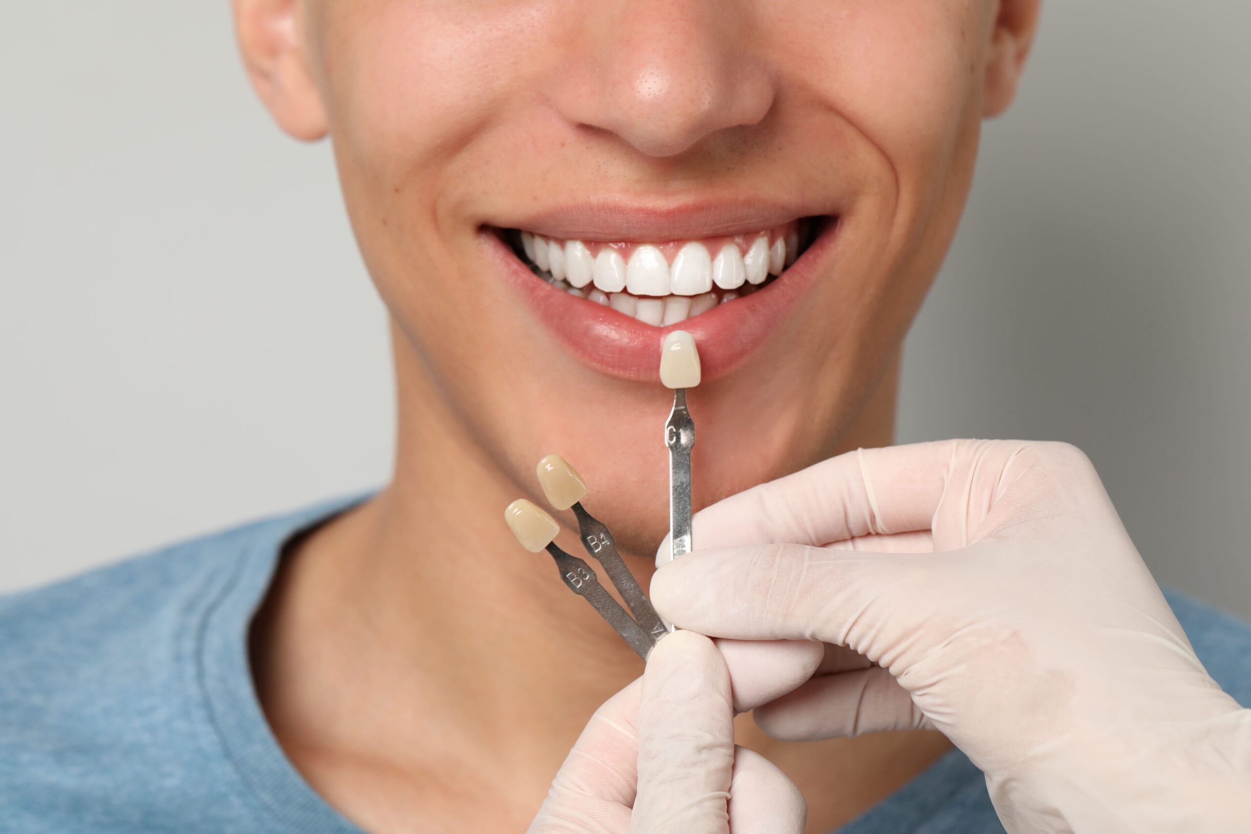 dentist in gloves checking dental veneer colors against a male patients teeth